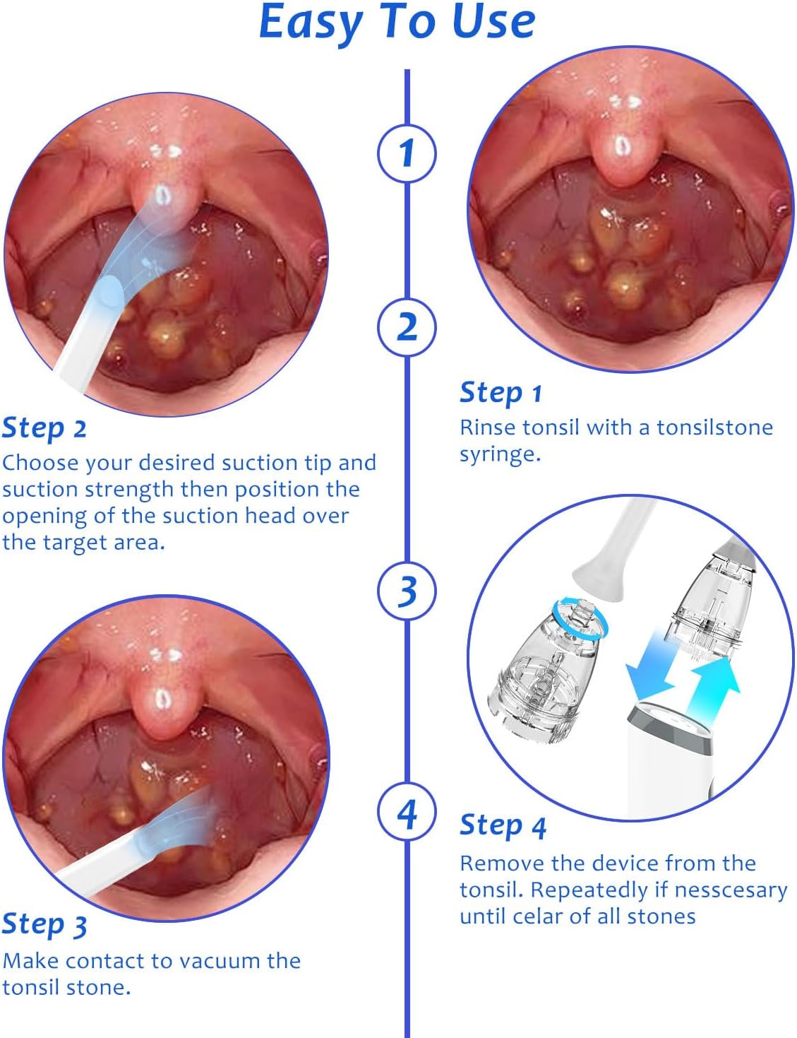 8 Suction Modes 3 Levels Tonsi - Electronics Repair And Maintenance 评论和价格